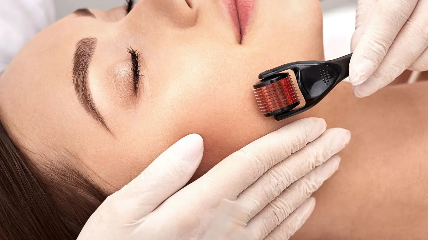 Microneedling Gesichtsbehandlung im Demaroller Collection für glatte Haut