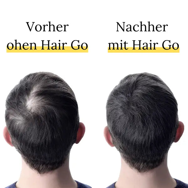 Hair Go Premium Kaschierpuder - Ansatzkaschierpuder